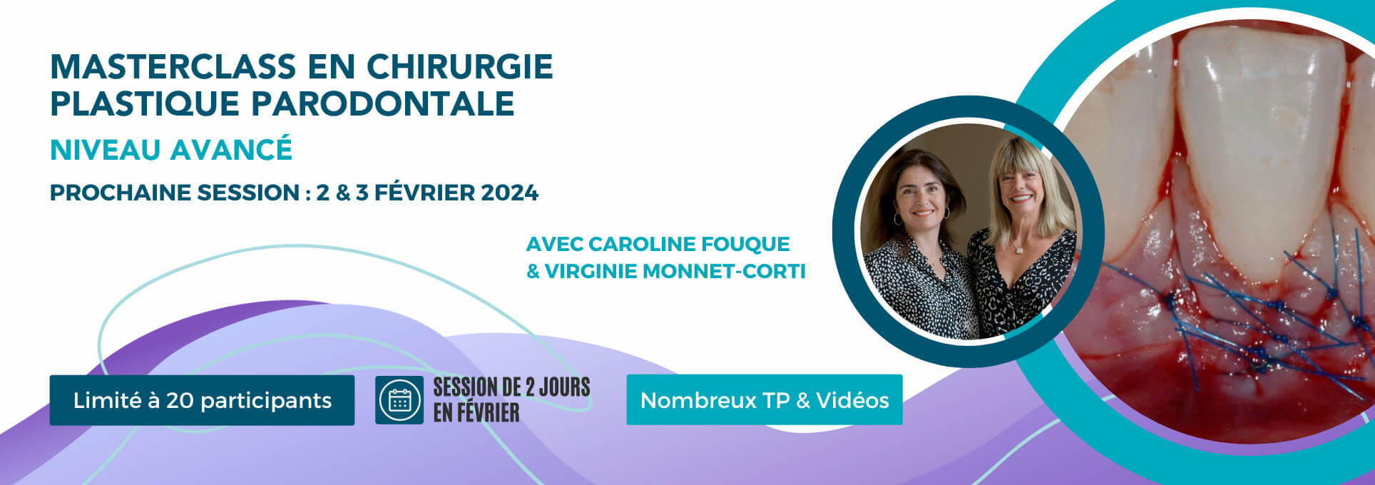 Masterclass en chirurgie plastique parodontale