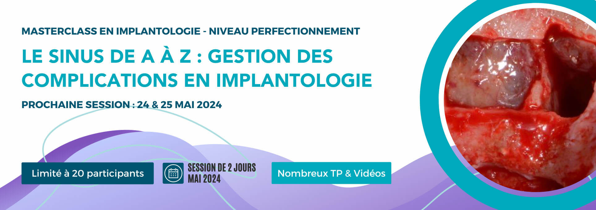Masterclass en implantologie