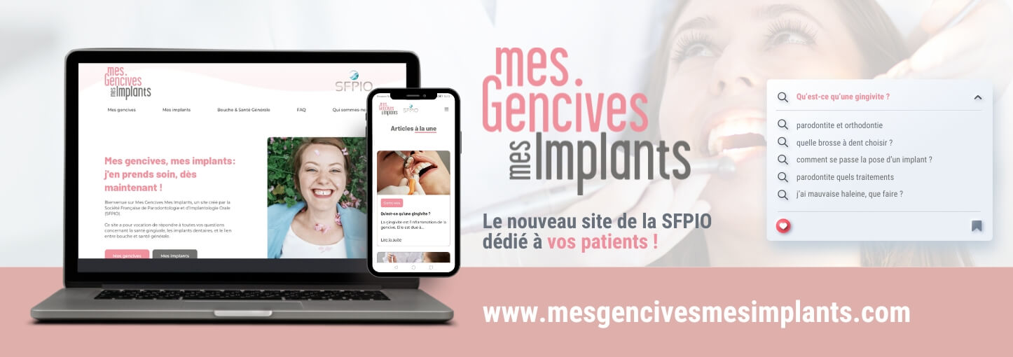 Mes Gencives Mes Implants